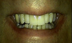Dentist Dallas TX