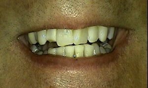 Dentist in Dallas Texas