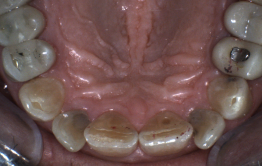 Dentist in Dallas Texas