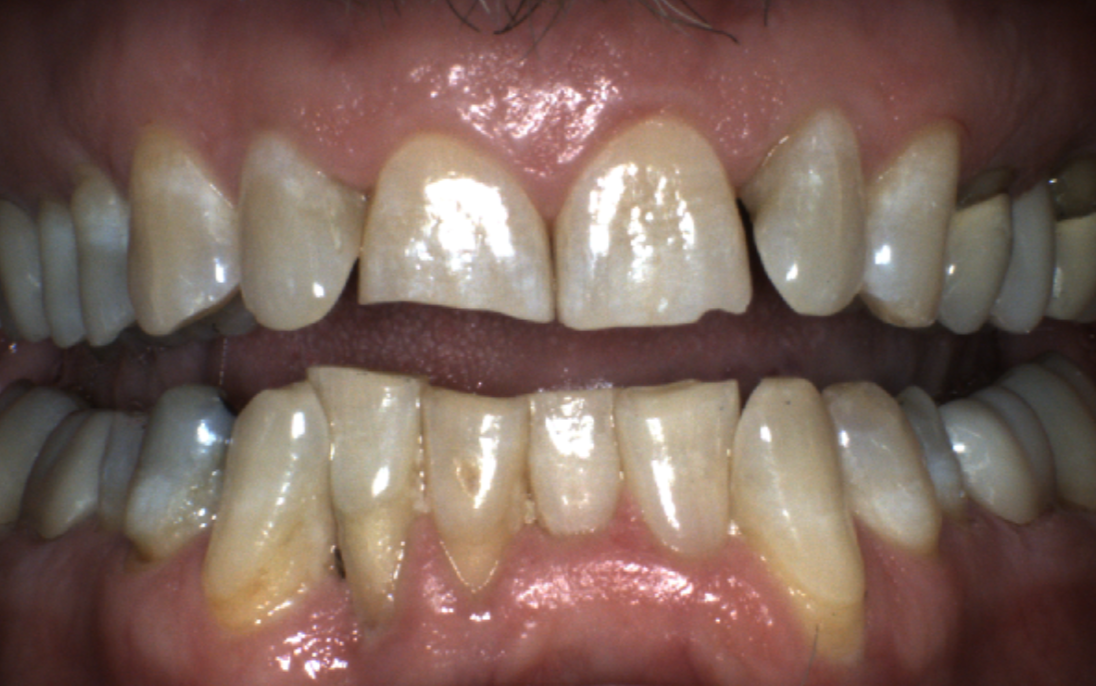 Dentist in Dallas Texas